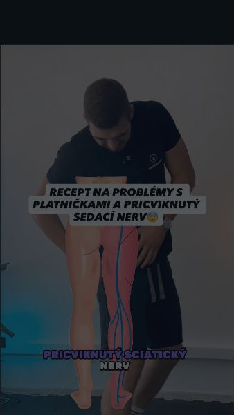 Ukážka práce so sedacím nervom